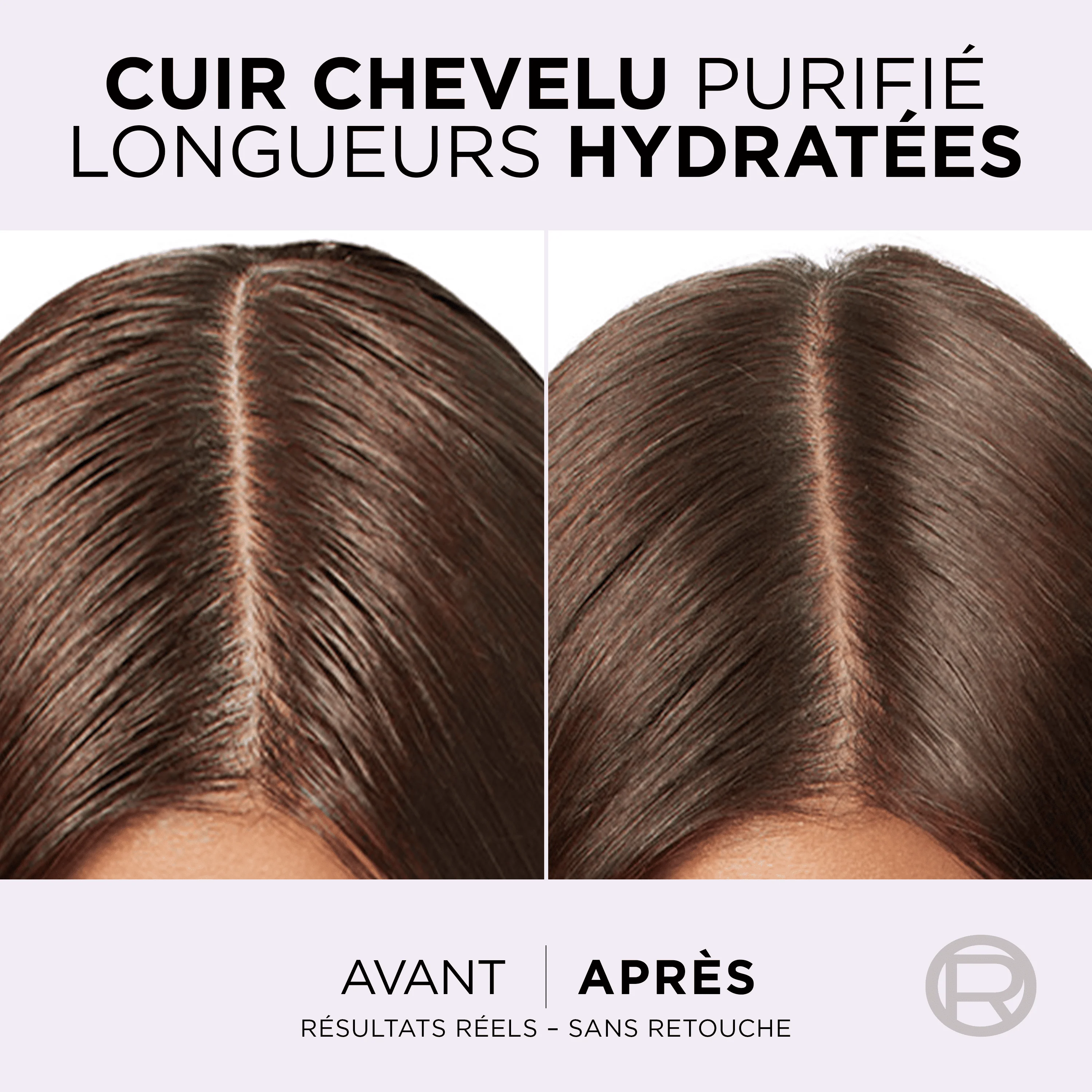 Elseve Routine Hyaluron Pure : SHP 200ML + AP SHP 200ML+ SERUM 102ML - Image 7