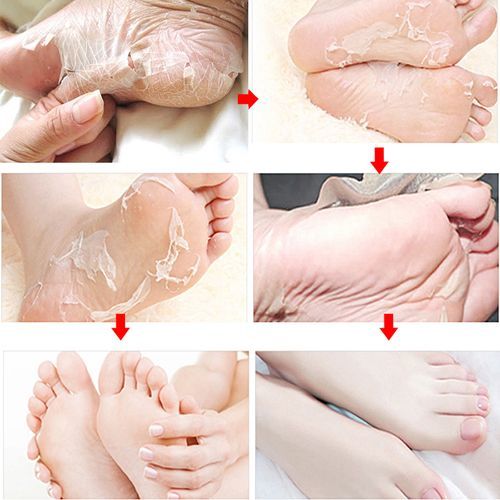 FOOTSTEPS CHAUSSETTES EXFOLIANTES - Image 3