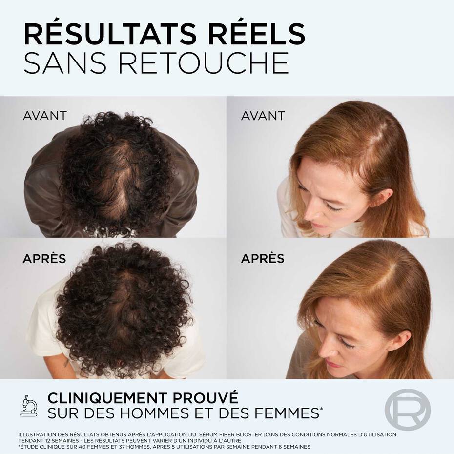 L'Oréal Paris Elseve Fiber Booster Sérum Anti-chute 102 ML - Image 8