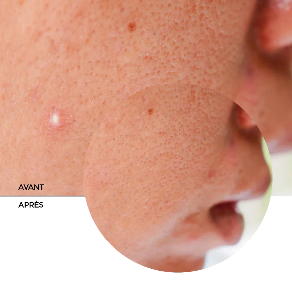 REVOX B77 JUST SUCCINIC ACID SPOT TREATMENT 25 ML - Image 5